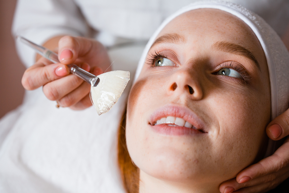 What Are the Best Chemical Peels for Acne in Fulton, Maryland?