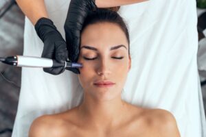 Here’s everything you need to know about same-day microneedling treatment and cost to make an informed decision!