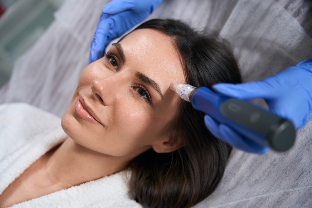 Microneedling Results Should Last How Long?